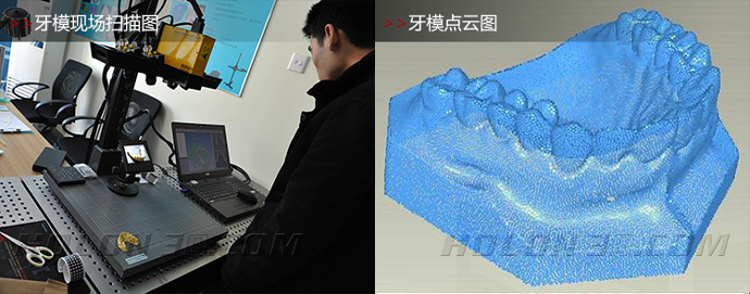 牙模三维扫描