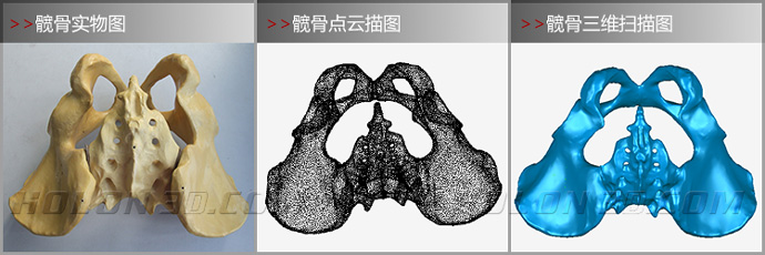 髋骨三维扫描