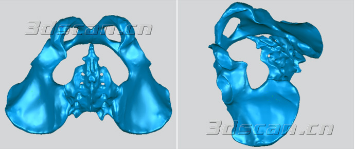 髋骨模型三维数据