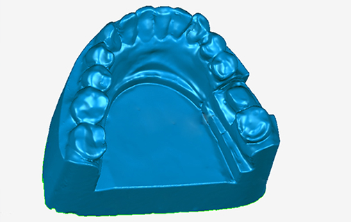 Application of 3D scanner in the field of dental medicine